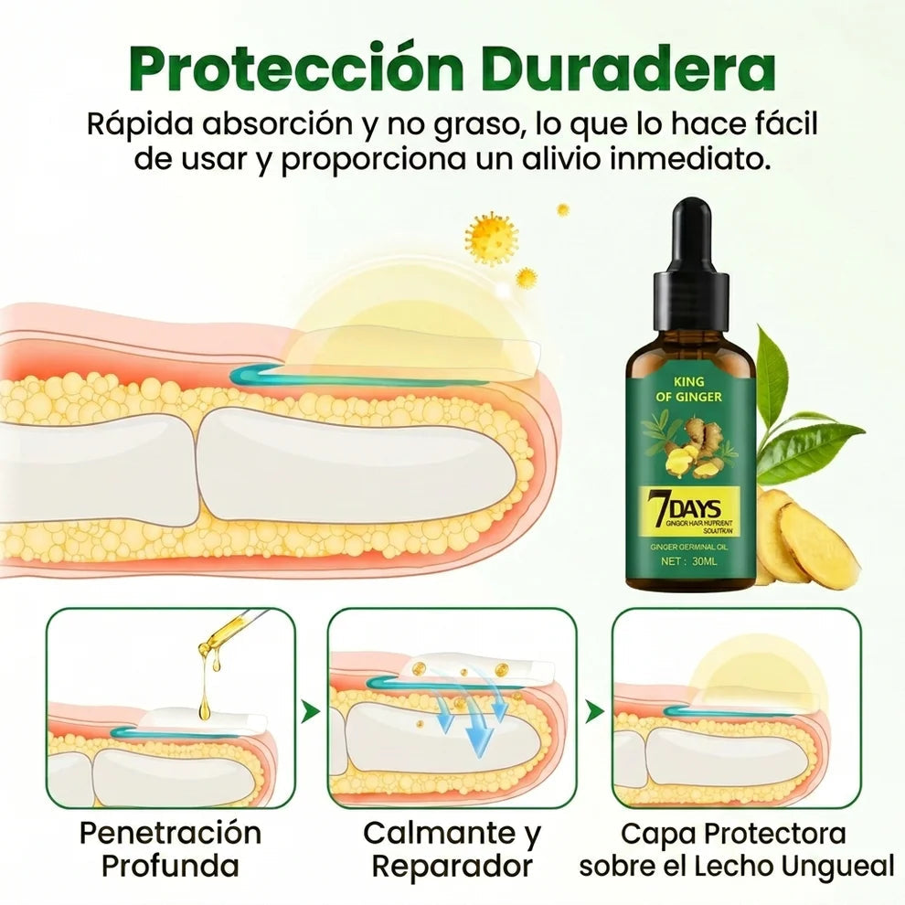 Tratamiento Anti Hongos - en Uñas Amarillas y las Fortalece desde 7 Días