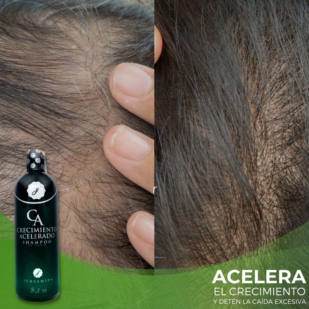 SHAMPOO CRECIMIENTO ACELERADO + OBSEQUIO (MASCARILLA CAPILAR)