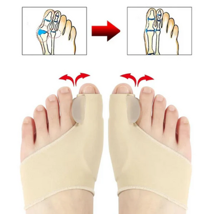 ComfortToe Corrector (1 Par) de Juanetes Ortopedicos